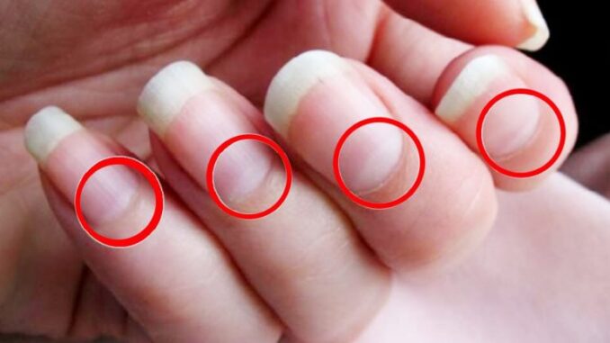 10 Things Your Nails Can Tell You About Your Health